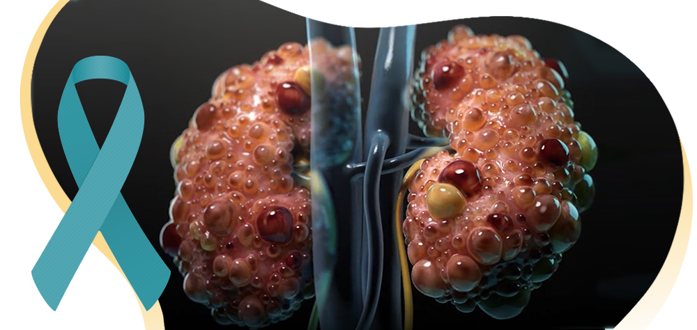 September 4th is PKD Awareness Day