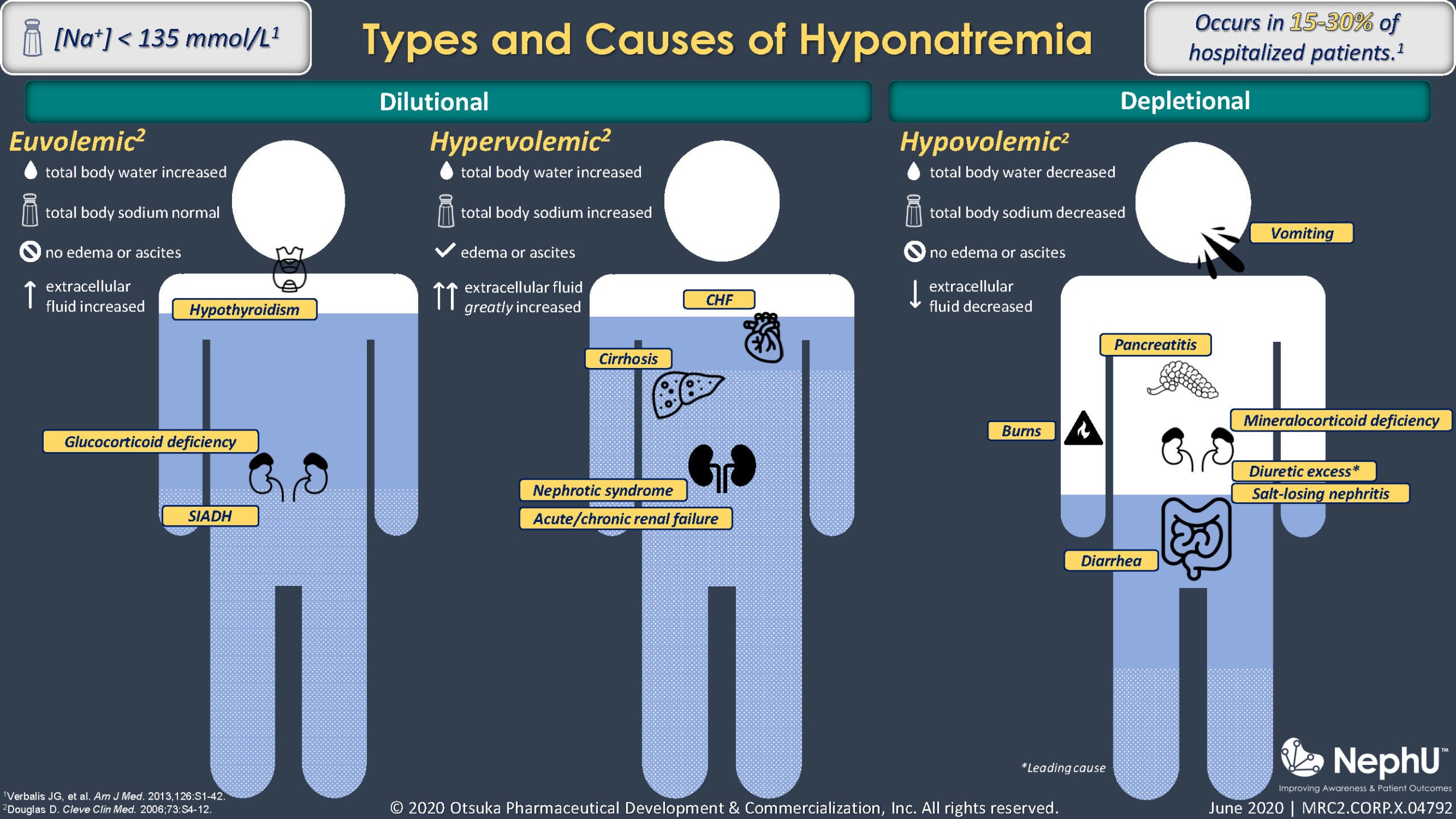 Hyponatremia Stages