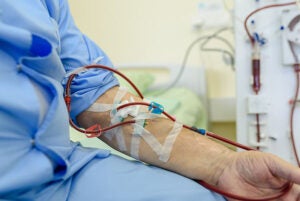 What Are Best Infection Prevention Practices For Hemodialysis & Peritoneal Dialysis?